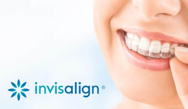 invisalign